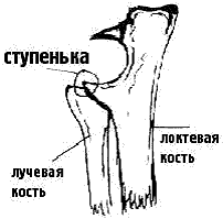   Processus coronoideus med.